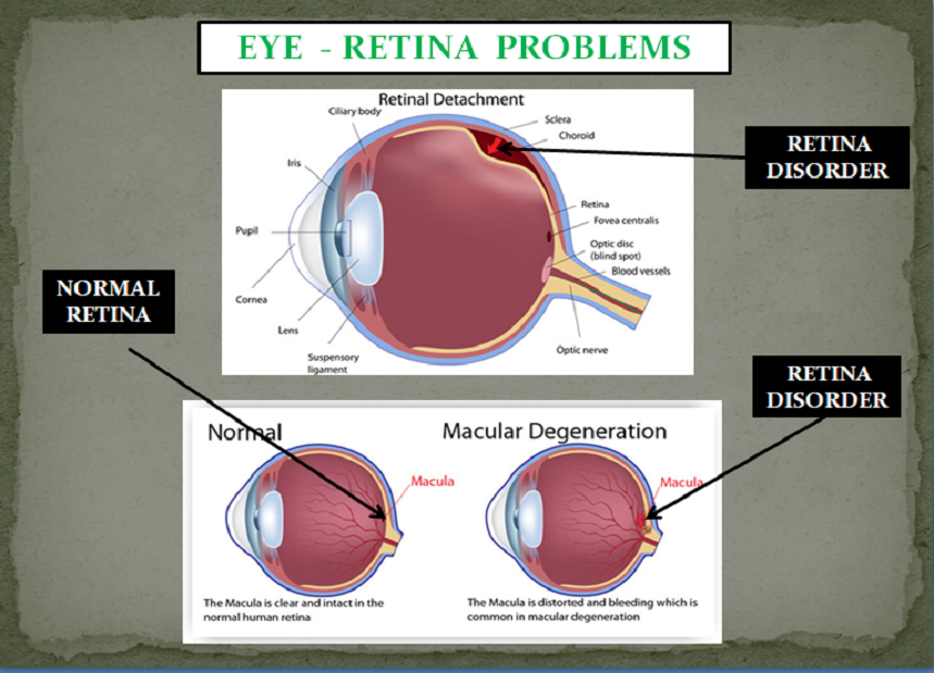 EYE PROBLEMS PACKAGE