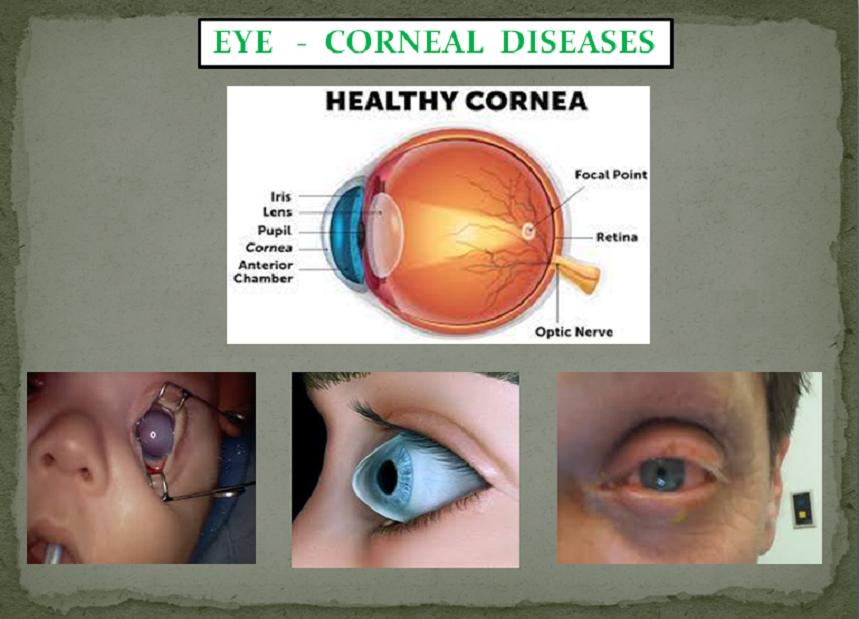 EYE PROBLEMS PACKAGE