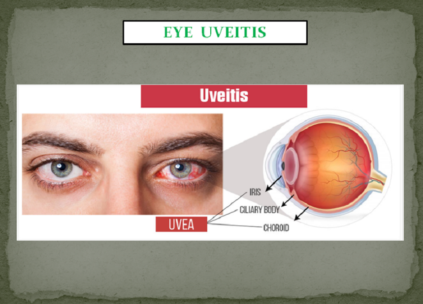 EYE PROBLEMS PACKAGE