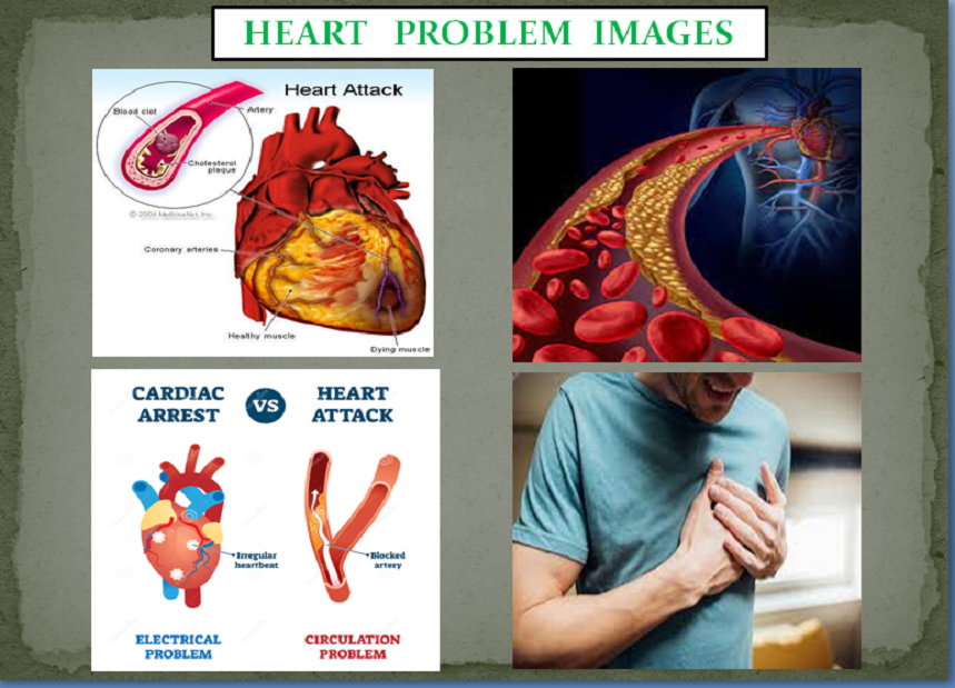 Heart Problems Package